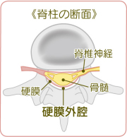 硬膜外ブロック