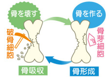 骨粗鬆症の原因