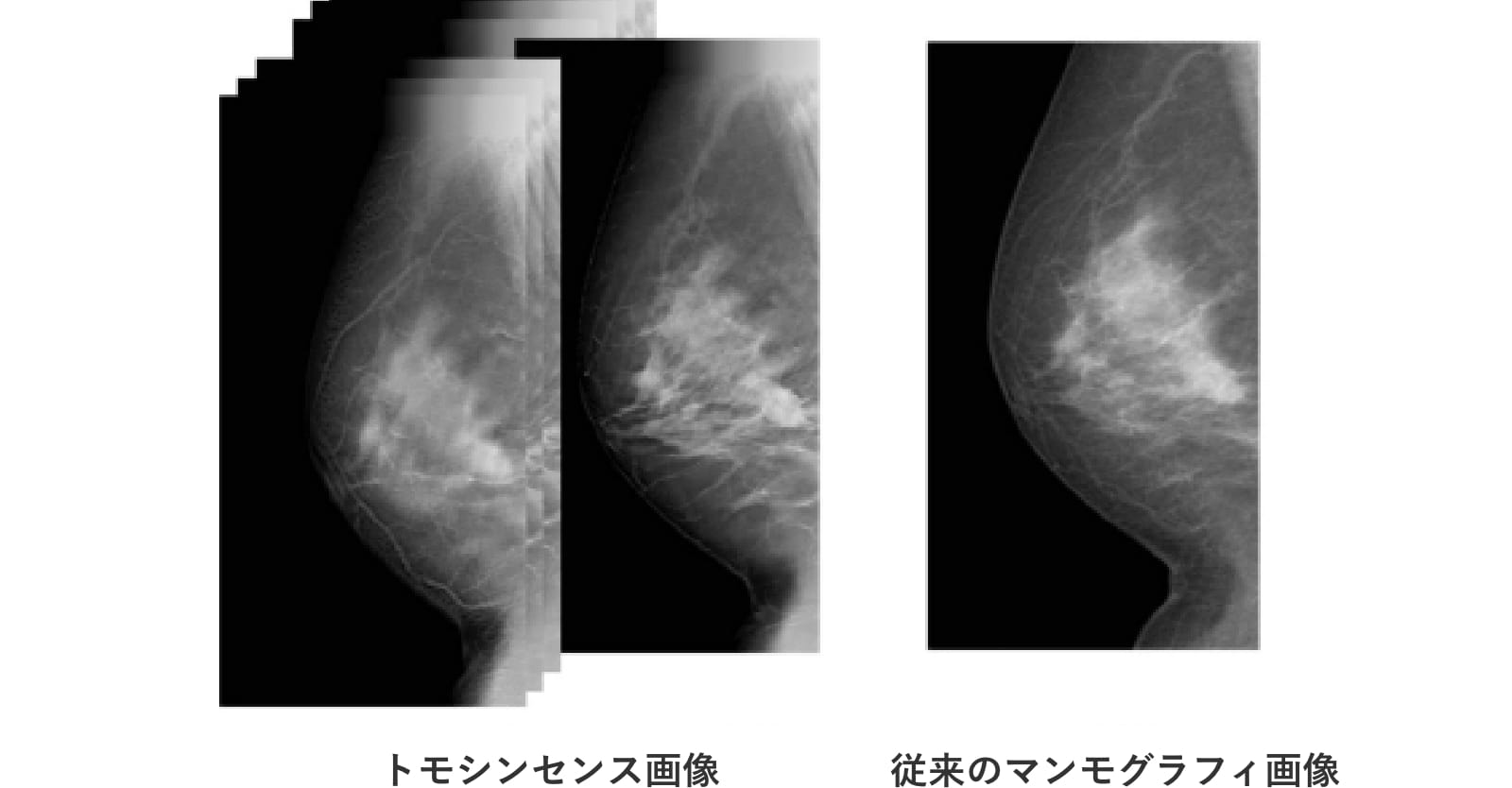 トモシンセシス