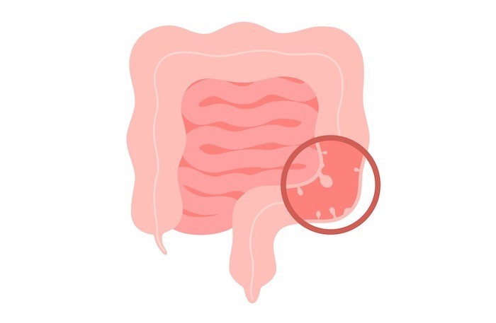「消化管疾患の検査と治療」について の画像