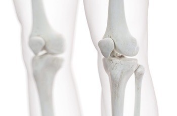 「変形性股関節症・変形性膝関節症」について の画像