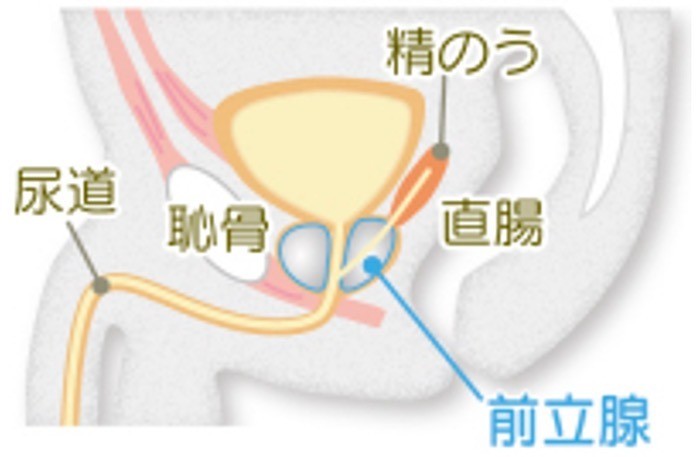 「前立腺がん」とは の画像